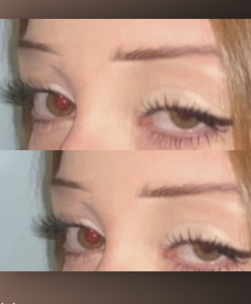 RUPTURA